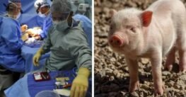 Realizan el primer trasplante de pulmón de cerdo a un humano en muerte cerebral